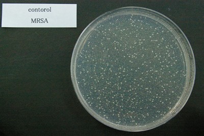 黄色ブドウ球菌未処理